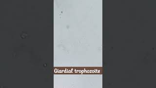 Microscopic identification of Giardia lamblia  cysts and trophozoite [upl. by Akisey]