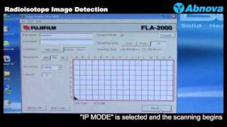 Radioisotope Image Detection [upl. by Artekal]