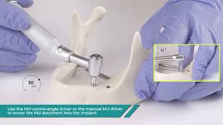 How to use Mesa Bone Profiler and MU Abutment tools [upl. by Knarf]