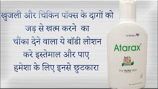 Atarax anti itch lotion ke fayde and review in hindi [upl. by Dhar690]