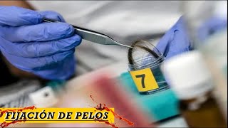 Aprende a fijar pelos  Microscopia  Criminalística [upl. by Llennaj]