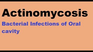 Actinomycosis  Bacterial infections of the oral cavity [upl. by Akihdar]