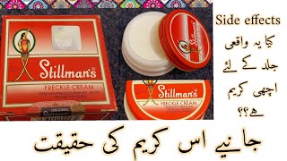 Stillmans freckle cream  Side effects  Honest Review on Stillmans freckle cream [upl. by Hsoj934]