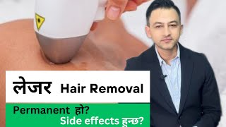 Laser Hair Removal in Nepal  Price Sessions Side effects and more [upl. by Evadne]