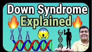 Down Syndrome explained  How it is caused [upl. by Jacky352]