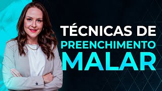 Live 026  Técnicas de preenchimento Malar [upl. by Daria]