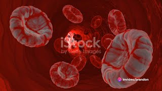 Etiopathogenic Classification of anemia  Hemolytic Anemia 03 [upl. by Adore]