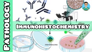 Immunohistochemistry  Pathology  USMLE NCLEX [upl. by Nehttam]