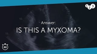 60 Seconds of Echo Teaching Answer Is this a myxoma [upl. by Erland]