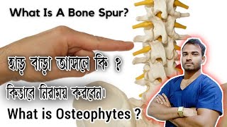 হাড় বাড়া আসলে কি  What is Osteophytes What is Bone spur [upl. by Erminie]