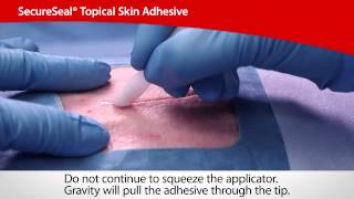 SecureSeal® Topical Skin Adhesive  Cardinal Health [upl. by Kirkpatrick]