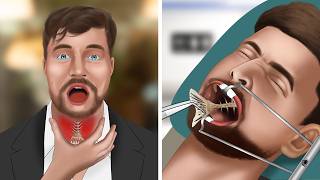 ASMR Animation Remove fish bones stuck in MrBeasts throat [upl. by Fenton]