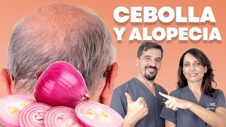 🔴 Cómo Preparar y Utilizar CEBOLLA para el Cabello 🧅 [upl. by Ettenom717]