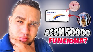 ACON 50000 VITAMINA A RETINOL PARA QUE SIRVE  DEBES SABER ESTO [upl. by Janelle]