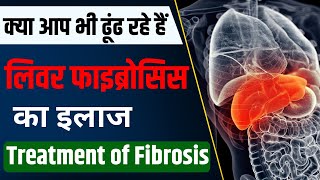 Liver Fibrosis Ka Ilaaj Kaise Kare FAST TRACK Your Recovery  Liver Fibrosis Treatment in Hindi [upl. by Aiuqal]