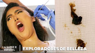 Cómo Se Extrae Profesionalmente La Cera De Los Oídos  Exploradores de Belleza  Insider Español [upl. by Leland731]