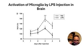 Inflammation Causes Depression [upl. by Arekahs]