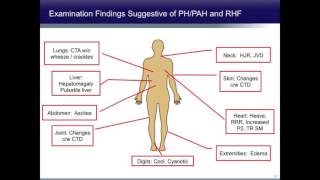 Pulmonary Arterial Hypertension Diagnosis Classifications and Therapy [upl. by Godric]