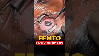 Live Femto Lasik Surgery [upl. by Notgnilra]