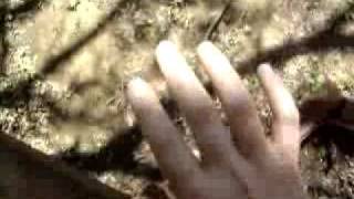 YouTube clonus hand tremor [upl. by Drusi635]