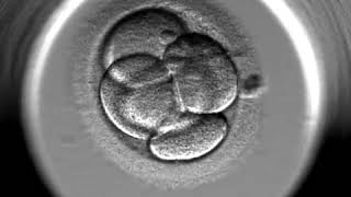 IVF Gynem Klinik  EmbryoScope  Entwicklung des Embryos [upl. by Oiramaj]