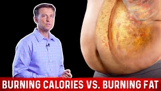 Burning Calories vs Burning FAT Calories – Dr Berg [upl. by Eirallam]