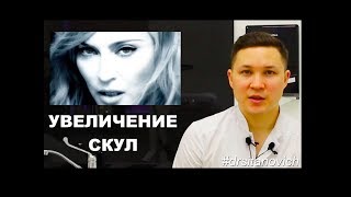 УВЕЛИЧЕНИЕ СКУЛ  Dr SItanovich [upl. by Annai]