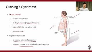 Secondary Hypertension Part 23 Endocrine Causes [upl. by Ariela]