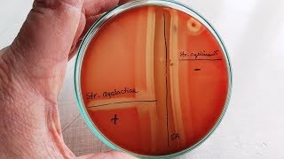 CAMP test for Streptococcus agalactiae  GBS [upl. by Henebry808]