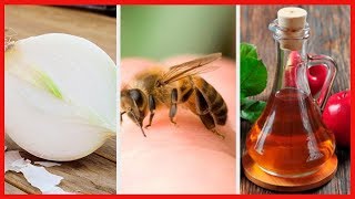 8 remedios caseros para curar las picaduras de abeja [upl. by Neehcas]