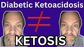 Is Keto Right For Diabetics [upl. by Etessil]