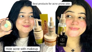 Best products for acne prone skin in Pakistan how to hide acne with makeup [upl. by Roswald]