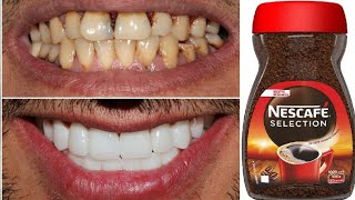 teeth whitening at home in 2 minutes  how to naturally whiten your yellow teeth [upl. by Jestude]