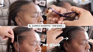 THIN EDGES TRANSFORMATION  TRACTION ALOPECIA HAIRSTYLE [upl. by Oslec861]