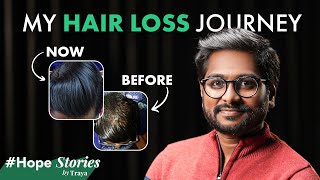 Can Stress from Exams Cause Hair Loss Watch Ajays Heartfelt Story of Hair Regrowth [upl. by Mae960]