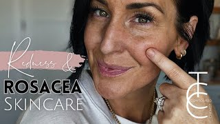 Redness and Rosacea  What you Need to Know and the Best Skincare Ingredients for your Routine [upl. by Moretta]