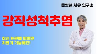 척추 골반이 굳어지는 강직성 척추염 최신 논문으로 보는 자가면역 질환 치료법 치료가능해요 해보세요 [upl. by Ueih410]