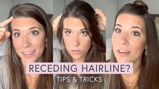 RECEDING HAIRLINE tips  tricks [upl. by Hali981]