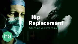 Hip Replacement  Everything you need to know [upl. by Barvick]