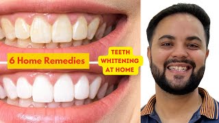 6 Natural Remedies for Teeth Whitening at Home [upl. by Olpe]