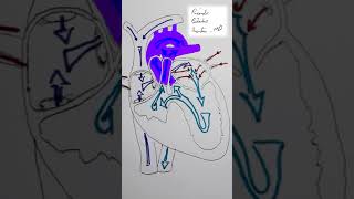 Tricuspid Atresia CHD Shorts [upl. by Mccreery]