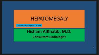 HEPATOMEGALY  Learning Radiology Flashcards 04 [upl. by Iron]