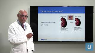 Kidney Disease What You Should Know  Anjay Rastogi MD  UCLAMDChat [upl. by Aubreir672]