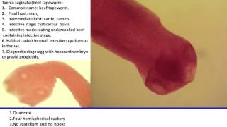 31 Practical Parasitology  Scolex of Taenia Saginata [upl. by Lena]