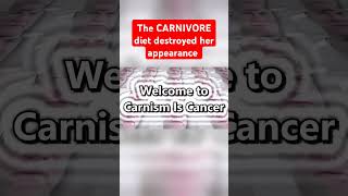 The CARNIVORE diet destroyed her appearance carnivore ketodiet [upl. by Nibroc]