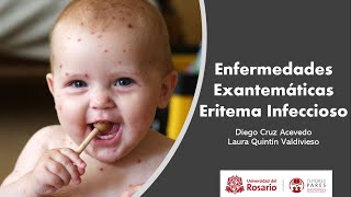 Enfermedades Exantemáticas Eritema infeccioso [upl. by Anehsat]