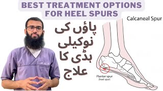 Heel Spur or Calcaneal Spur  Heel Pain Treatment In Hindi by DrALI Heel Pain Treatment amp Exercise [upl. by Woodcock]