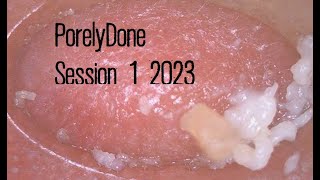 PorelyDone 2023week1 Pore Blackhead and Oil Vacuum Suction Removal [upl. by Rem]