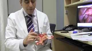 Endometriosis with Dr Cleve Ziegler [upl. by Danila31]