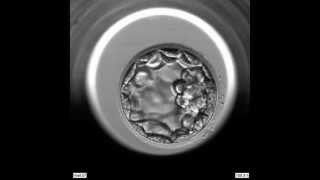 EmbryoScope Embryo Development  Blastocyst [upl. by Ahsiena]